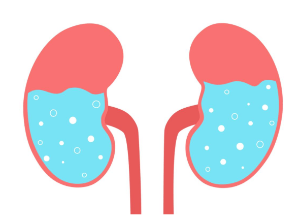 Drinking Water in Morning